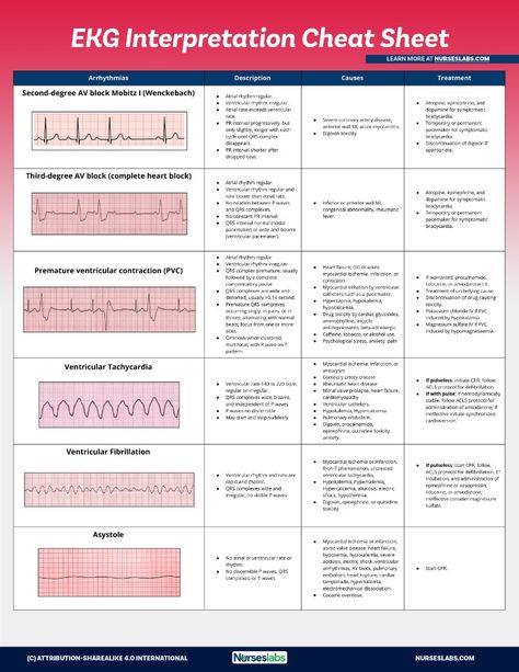 Use this EKG interpretation cheat sheet that summarizes all heart arrhythmias in an easy-to-understand fashion. Arrhythmias Nursing Cheat Sheets, Easy Ekg Interpretation Cheat Sheets, Heart Rhythm Nursing Cheat Sheets, Ekg Rhythms Cheat Sheets, Ekg Cheat Sheet, Telemetry Nursing Cheat Sheets, Ekg Interpretation Made Easy Cheat Sheets, Acls Cheat Sheet 2023, Acls Cheat Sheet 2019