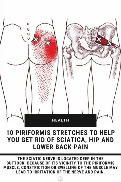 Sciatic Nerve Exercises, Sciatica Stretches, Piriformis Muscle, Hip Pain Relief, Piriformis Stretch, Sciatica Exercises, Piriformis Syndrome, Sciatica Pain Relief, Sciatica Relief