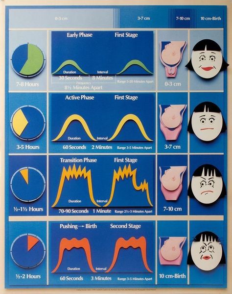 Labour stages: funny / terrifying poster Midwifery Student, Child Nursing, Labor Delivery Nursing, Stages Of Labor, Labor Nurse, Nursing Mnemonics, Pregnancy Labor, Childbirth Education, Birth Doula