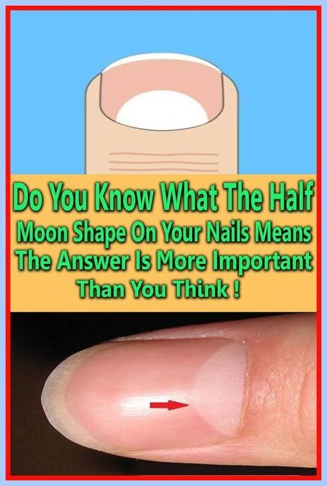 DO YOU KNOW WHAT THE HALF MOON SHAPE ON YOUR NAILS Moon On Nails, Layers Of The Epidermis, Skin Moles, Online Newsletter, Types Of Skin, Word Online, School Communication, Creating A Newsletter, Health Planner