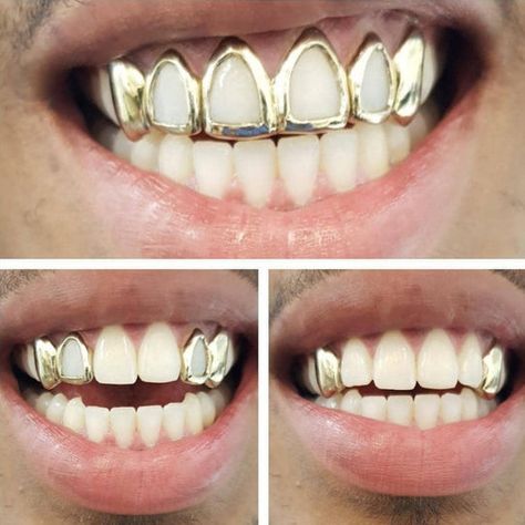 Silver Teeth Caps, Window Caps Teeth, Window Grillz Teeth, Gold Caps Teeth, Female Grills Teeth Gold, Grillz Teeth Female, Grillz Teeth Men, Female Grills, Gold Tooth Cap