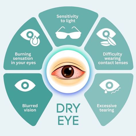 Optician Training, Eye Health Facts, Optometry Education, Optician Marketing, Creative Sunglasses, Eyewear Store Design, Dry Eye Symptoms, Eye Facts, Eye Anatomy