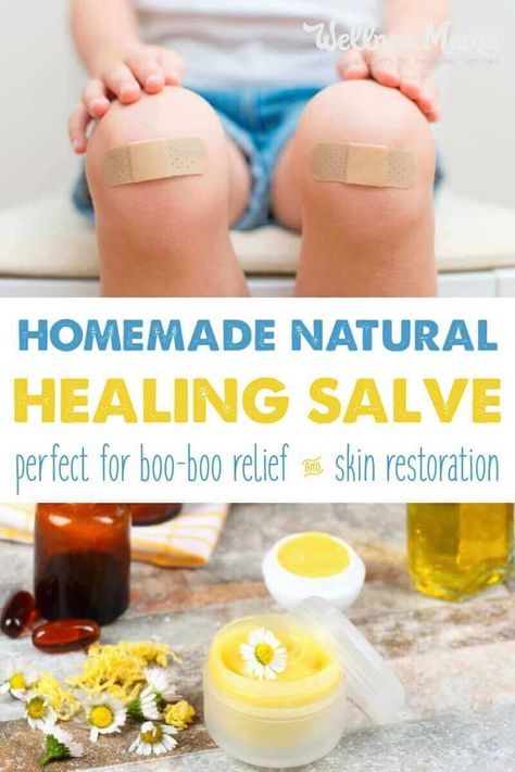 Homemade Antibiotic Ointment, Homemade Healing Salve, Homemade Antibiotic, Healing Salve Recipe, Best Cough Remedy, Homemade Cough Remedies, Dry Cough Remedies, Healing Salve, Salve Recipes