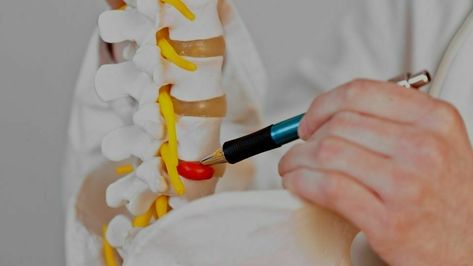 Bulging Disc vs. Herniated Disc: What's The Difference? L5 S1 Disc Herniation, Bulging Disc, Disk Herniation, Nutritional Deficiencies, Nutrition