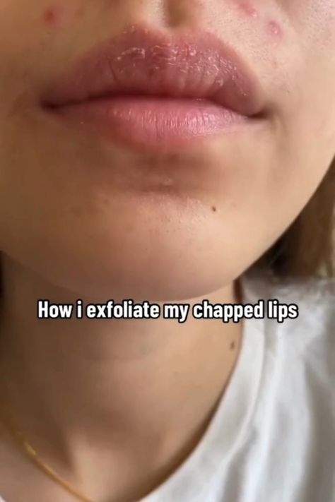 Say Goodbye to Chapped Lips: Essential Tips for Healthy, Soft, and Rosy Lips. Discover how to treat dry lips and stop lips from peeling with these expert tips! Learn effective ways to fix chapped lips and achieve healthier, softer, and more beautiful lips. Whether you need to get rid of smokers lips or simply want to enhance your lip care, these essential tips and tricks will guide you to your best lips yet. #HealthyLips #ChappedLips #LipCare #BeautyTips Tips For Chapped Lips, How To Stop Lips From Peeling, Diy Lip Exfoliator Recipes, How To Heal Cracked Lips, How To Fix Chapped Lips, How To Treat Dry Lips, Healthy Lips Tips, How To Heal Chapped Lips Fast, How To Get Rid Of Smokers Lips