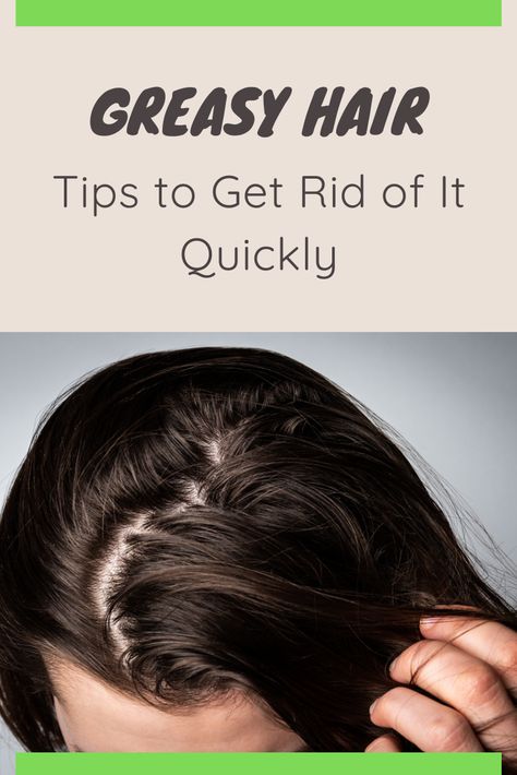 How To Help Greasy Hair, How To Fix Greasy Hair, Greasy Hair Tips, Fix Greasy Hair, Greasy Hair Hairstyles For Work, Greasy Hair Remedies, Prevent Greasy Hair, Bad Hairline, Fix Makeup