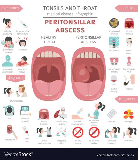 Medical Infographic Design, Boy Presents, Disease Infographic, Medical Infographic, Mouth Hygiene, Hospital Medicine, Family Nurse Practitioner, Blood Sugar Diet, Presents For Boys