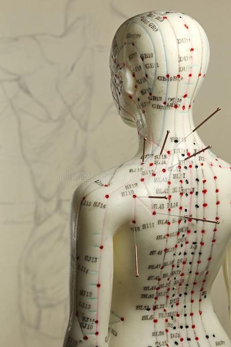 Traditional Chinese Medicine Acupuncture, Acupuncture Points Chart, Tcm Traditional Chinese Medicine, Acupuncture Point, Hurt Pain, Acupuncture Needles, Human Body Anatomy, Cupping Therapy, Acupuncture Points