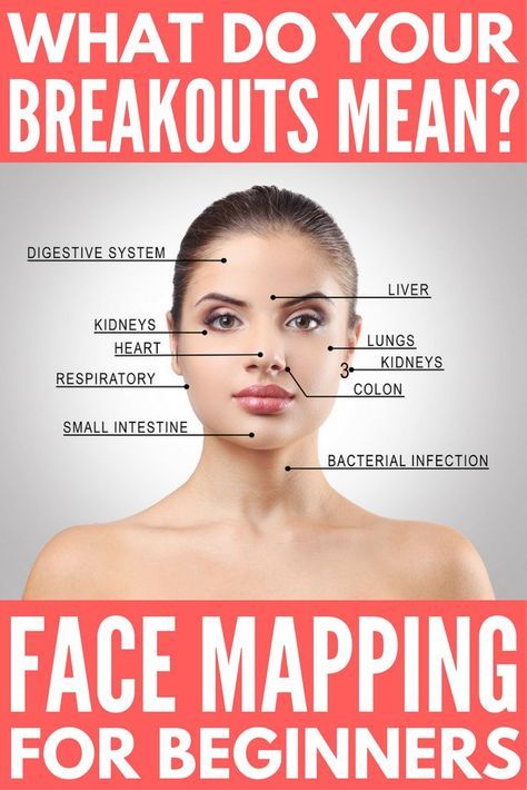 Your complete breakout map guide! If you haven’t heard of face mapping, take note! The location of your acne and breakouts isn’t random, it can actually tell you a lot about your health. If you struggle with bad skin and have exhausted all of the products and natural remedies that promise to get rid of acne without success, we’re sharing our best tips to help you understand what your breakouts mean and what you can do to control and (hopefully) eliminate them completely. Breakout Map, Doterra Acne, Gesicht Mapping, Face Mapping Acne, Bad Skin, Face Mapping, Get Rid Of Acne, Rid Of Acne, Natural Acne Remedies