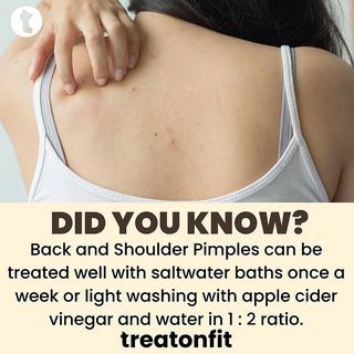 Mother Nature Heals on Instagram: “Double tap If you want more posts like this ❤🙏 . Follow our new page @betterremedies for natural remedies and much more 🙏 . Tag someone…” Arm Pimples, Keratosis Pilaris, Vinegar And Water, Home Health Remedies, Upper Arms, Home Health, Double Tap, Health Remedies, Natural Healing