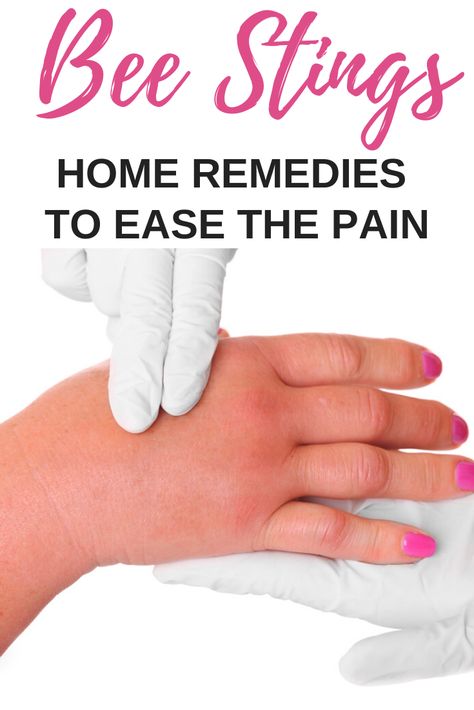 Getting stung by a bee, hornet, wasp, or yellow jacket HURTS.  Here are some home remedies to reduce swelling and take the 'ouch' out of getting stung by a bee! #outdoorliving #healthandwellness #naturelovers Natural Bee Sting Remedy, Bee Stings Relief Swelling, Wasp Sting Remedy Swelling, Bee Sting Remedy, Bee Sting Swelling, Wasp Sting Remedy, Swelling Remedies, Remedies For Bee Stings, Bee Repellent