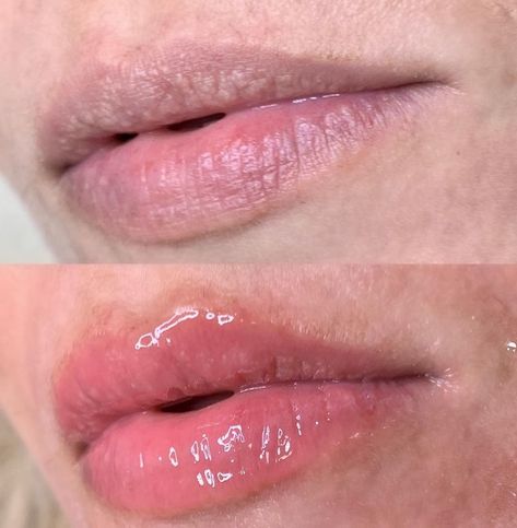 Hidragloss Lip, Hydra Gloss Lips, Gloss Lips, Lips Gloss, Lip Drawing, Beauty Academy, Lip Scrubs, America Latina, Gloss Labial