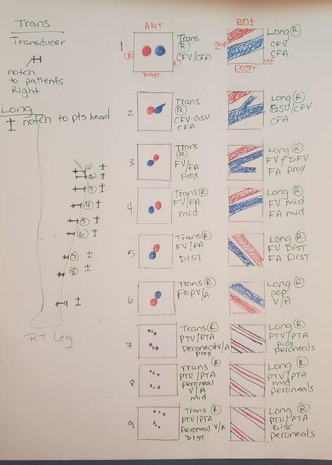 Upper Extremity Venous Ultrasound, Ultrasound Venous Leg, Lower Extremity Arterial Ultrasound, Vascular Ultrasound Notes, Lower Extremity Venous Ultrasound, Carotid Artery Ultrasound, Ultrasound Graduation Pictures, Sonography Notes, Pediatric Ultrasound