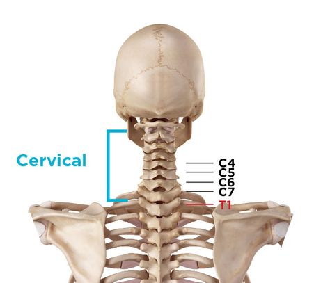 Cervical Herniated Disc Exercises For Upper Back Pain, Bulging Disc In Neck, Narrowing Of The Spine, Exercises For Upper Back, Causes Of Back Pain, Spine Pain, Neck Problems, Bulging Disc, Back Stretches For Pain