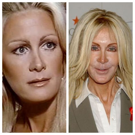 Joan Van Ark ..... What happened.....before and after Joan Van Ark, Bad Celebrity Plastic Surgery, Bad Plastic Surgeries, Plastic Surgery Fail, Plastic Surgery Gone Wrong, Actress Hairstyles, Celebrity Plastic Surgery, Celebrities Then And Now, Celebrities Before And After