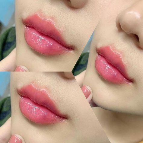 Korean Lip Surgery, Korean Lip Filler, Cupids Bow Lips, Filler Lip, Lip Surgery, Heart Shaped Lips, Lip Lightening, Lips Inspiration, Botox Lips