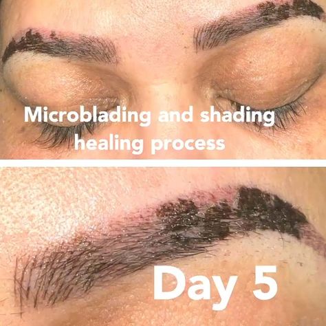 Microblading Ghosting Phase: What Is It and Is It Normal? Microblading Healing Process By Days, Micro Blading Healing Process, Brow Microblading Before After, Stages Of Microblading Healing, Combo Brows Healing Process, Ombre Microblading Eyebrows, Microblading Eyebrows Healing Process, Powder Brows Healing Process, Microblading Healing Stages