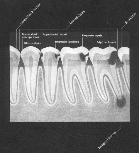 Dental Assistant Study Guide, Dental Assistant School, Dental Assistant Study, Dental Hygiene Student, Dental Images, Dental Posts, Dental Videos, Kedokteran Gigi, Dental Hygiene School