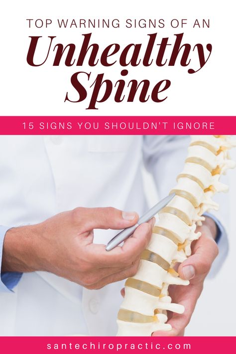 Top warning signs of an unhealthy spine and tips to improve your posture that will help you avoid future back problems and back pain. Click for the 15 warning signs of an unhealthy spine and what you can do to keep your spine healthy. Chiropractic and exercise are always recommended. #backpain #healthyspine #backproblems #chiropractics #wellness Stretches To Decompress Spine, Spine Health Tips, How To Realign Your Spine, How To Decompress Spine, Decompress Spine, Swelling Remedies, Straight Spine, Brain And Spinal Cord, Spine Problems