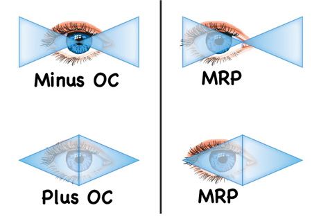 2: Optical Center vs. Major Reference Point - OpticianWorks Online Optician Training Opthalmic Technician, Optician Training, Eye Health Facts, Optician Marketing, Contact Lens Care, Eye Anatomy, Eye Test, Study Time, Eye Health