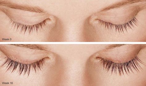 Rory | Latisse Eye Lash Growth, Eyelashes Longer, Grow Eyelashes, Lashes Tips, Eyelashes And Eyebrows, Makeup Asian, Lasik Surgery, Pharmacy Store, Parts Of The Eye