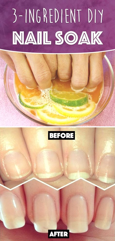 This 3-Ingredient DIY Nail Soak Miraculously Rejuvenates your Nails and Boosts their Growth! Diy Nail Soak, Do It Yourself Nails, Nail Soak, Nail Care Tips, How To Grow Nails, Brittle Nails, Nail Growth, Strong Nails, Nail Health