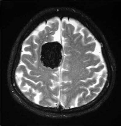 Brain Xray, Brain Mri, Science Aesthetic, Mri Brain, Radiology Imaging, Mri Scan, Ct Scan, Human Anatomy And Physiology, Science Biology