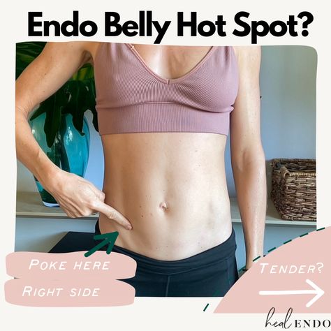 Endo Flare Up Tips, Endo Belly Remedies, Stage 4 Endo, Endo Belly, Ovary Pain, Endo Diet, Small Intestine Bacterial Overgrowth, Low Estrogen Symptoms, Hormone Health