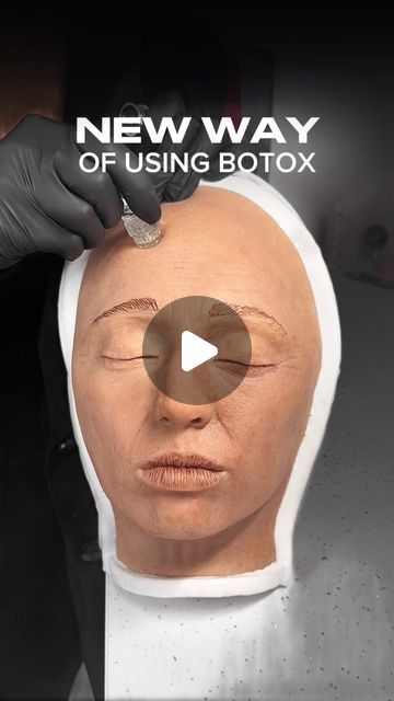 Natalie Page Aesthetics on Instagram: "Mesotox: the latest approach to skin tightening with Botox 🩶✔️

This advanced technique delivers Botox mixed with skinbooster in micro-doses across the skin’s surface, reducing fine lines and improving texture for a smooth, lifted look💉

Want to start offering Mesotox? Find the online training on the Natalie Page Pharma website 🫶🏼

#botox #botoxcapilar #botoxnatural #botoxchallenge #botoxcheck #botoxfacial #antiwrinkle" Skin Tightening, Online Training, Anti Wrinkle, To Start, Facial, Texture, Skin, Instagram