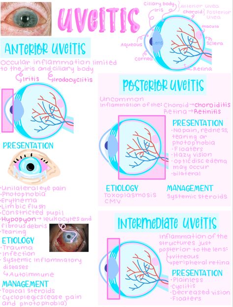 Optometry Notes, Optometry School Notes, Ocular Anatomy, Anatomy Of Eye Notes, Ophthalmology Notes, Opthamology Notes, Iridology Chart Eye, Eye Disorders Nursing, Opthalmic Technician