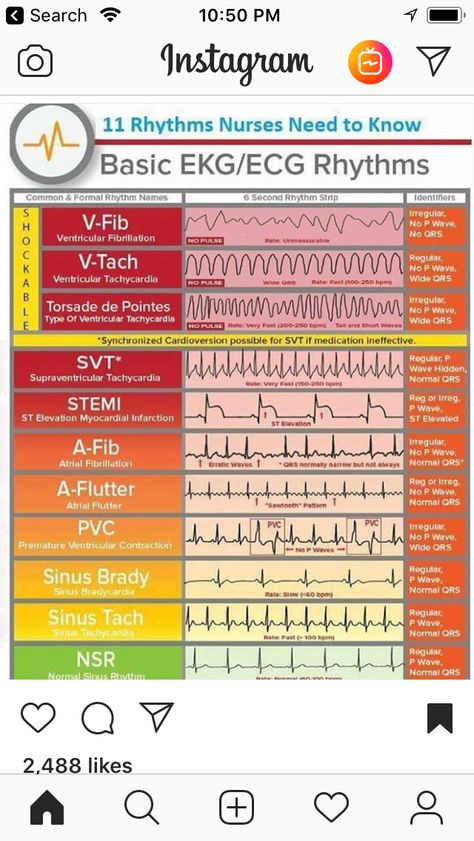 Urgent Care Nurse, Room Basic, Ed Nurse, Nursing School Essential, Emergency Room Nurse, Basic Anatomy And Physiology, Nurse Study Notes, Nursing Schools, Cardiac Nursing