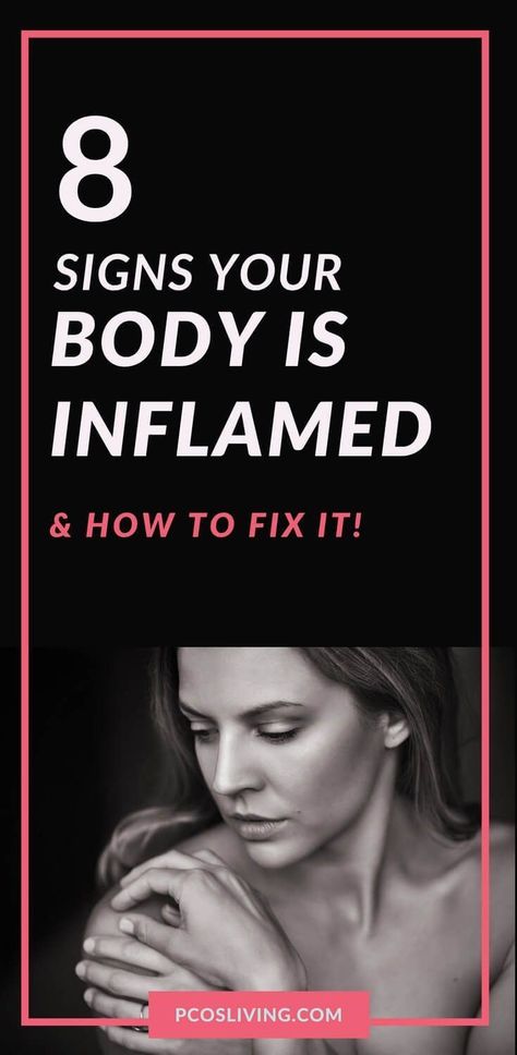 Remedies For Inflammation, Eat Natural, Inflammation Remedies, Signs Of Inflammation, Body Inflammation, Inflammation Diet, Holistic Health Remedies, Home Remedy For Cough, Anti Inflammation