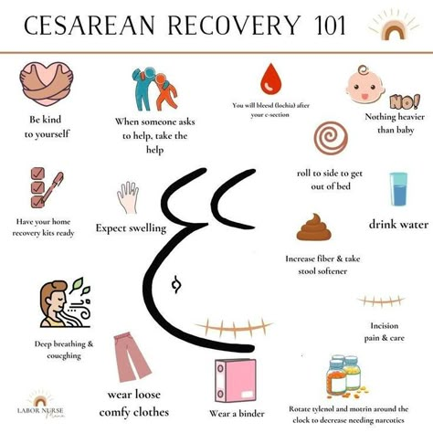 Postpartum Awareness, Postpartum Advice, Cesarean Recovery, Labor Doula, Birth Tips, Postpartum Care Kit, C Section Recovery, Pregnancy Help, Baby Delivery