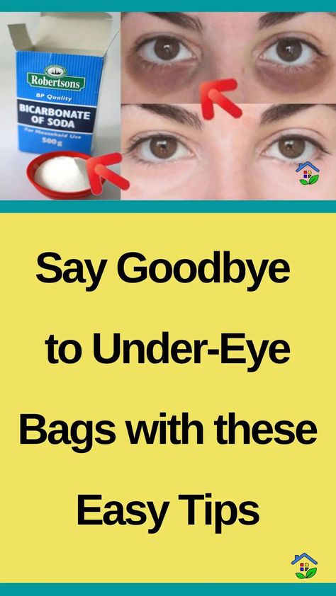 Dark circles under your eyes make you look tired and worn out. We already know that You have tried so many remedies in vain, and for that, we are here to help. Each remedy has its undesirable side effects, but have you ever thought about baking soda? This time, we have chosen a natural remedy […] Baking Soda For Eye Bags, Dark Under Eyes Remedy, How To Get Rid Of Dark Circles Under Eye Fast, Under Eye Puffiness Remedies, Depuff Under Eyes, Remove Bags Under Eyes, Dark Circles Under The Eyes Remedies, Baking Soda Under Eyes, Undereye Bags Remedy