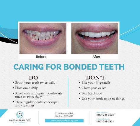 Improve Dental Hygiene, Teeth Bonding, Antiseptic Mouthwash, Dental Bonding, Dental Hygiene, Your Smile, Mouthwash, Oral Hygiene, Quick Saves