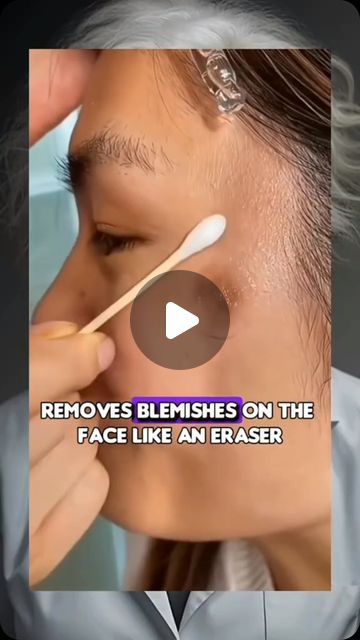 The BEST Products on Instagram: "NATURAL RECIPE TO REMOVE STAINS FROM THE FACE 

🌿Slimming Gel Fat Burning Full Body ❤️
🪬Burn fat to reduce fat and remove oil
‼️ 7 days to see results... Link in my bio ⬆️

#health #healthy #healthyrecipes #healthytips #naturalremedies #naturalhealing #skin" Blemish Remover, Remove Stains, Burn Fat, Health Healthy, Natural Food, Stain Remover, Natural Healing, Healthy Tips, Best Products