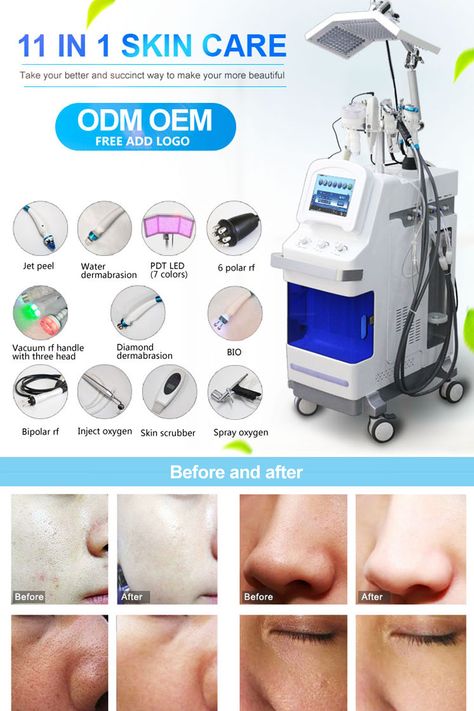 Facial Aesthetic, Oxygen Facial Machine, Oxygen Facial, Aesthetic Clinic, Best Selling Products, Selling Products, Skin Rejuvenation, Beauty Salon, Facial