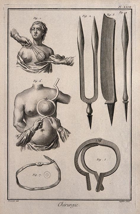 Jupiter Facts, Male Artworks, Surgery Instruments, Wellcome Collection, Comic Tutorial, Copper Engraving, Swag Art, Collage Artwork, Medical Illustration