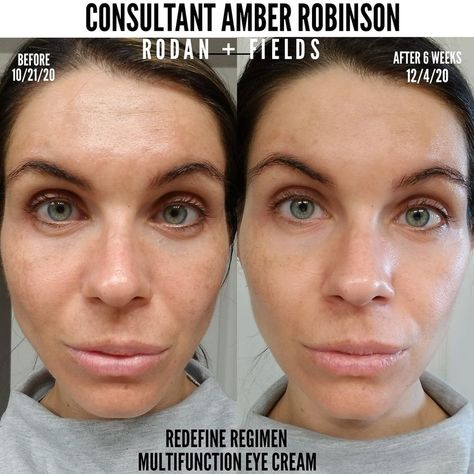 If visible signs of aging (wrinkles, fine lines, loss of elasticity) are present or if you're wanting to prevent premature aging use the #1 anti-aging skincare brand of North America. The Redefine regimen softens, exfoliates, and moisturizes your skin to minimize pores, smooth lines, and wrinkles. It also visibly lifts, sculpts, and firms up your skin and works 3x better, 2x faster on wrinkles. Allow me to help you get started to looking your best! Let's chat! Multifunction Eye Cream, Redefine Regimen, Anti Aging Regimen, Anti Aging Skincare Routine, Life Changing Skincare, Skincare Brand, Minimize Pores, Best Skin, Rodan And Fields