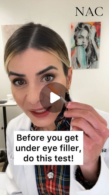 Under Eye Plumper, Hallow Undereye, Under Eye Hollows Remedies, Eye Fillers Before And After, Hollow Eyes Remedy, Sunken Eyes Aesthetic, Facial Contouring Fillers, Filler Under Eyes Before And After, Undereye Filler Before And After