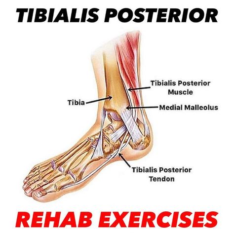 Dr. Tom Walters, DPT, OCS on Instagram: "💥𝐓𝐢𝐛𝐢𝐚𝐥𝐢𝐬 𝐏𝐨𝐬𝐭𝐞𝐫𝐢𝐨𝐫💥 ——— 🔎Tibialis Posterior is a relatively small muscle that runs along the inside of the lower leg. This muscle acts to invert and plantarflex the ankle and helps support the arch of the foot.  🧠Dysfunction of the tibialis posterior tendon can cause pain along the inside of the lower leg and be one cause of posterior shin splints. More severe injuries of tibialis posterior can result in a gradual collapse of the arch of the foot.  ✅If you have pain in this region, the resistance training exercises shown here can work to increase muscle strength and tendon capacity and decrease pain. Give them a try and let me know if you have any questions.  1️⃣Arch Doming 2️⃣Band Inversion 3️⃣Calf Raise 4️⃣Single-Leg Squat To Posterior Shin Splints, Resistance Training Exercises, Tibialis Posterior, Ankle Rehab, Resistance Training Workouts, Foot Exercises, Training Exercises, Foot Reflexology, Shin Splints