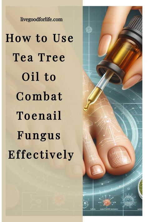 [object Object] Natural Remedies For Toenail Fungus, Tea Tree Oil For Nail Fungus, Tea Tree Oil For Toenail Fungus, Tea Tree Oil Hair, Fungal Infection Remedies, Toenail Fungal Infection, Tea Tree Oil Uses, Benefits Of Tea, Toenail Fungus Remedies