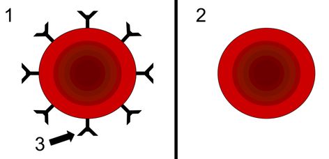 What is Rh negative blood? – Rh Negative Blood and People Rh Blood Type People, Rh Negative Blood Facts, A Negative Blood, Abo Blood Group System, Rh Factor, Rh Negative, Blood Group, Blood Groups, Blood Bank