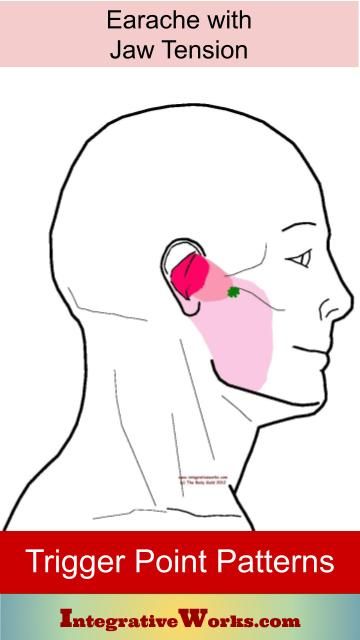 Earache with Jaw tension - Integrative Works Ear Ache, Forward Head Posture Exercises, Neck And Shoulder Muscles, Jaw Pain, Head Pain, Forward Head Posture, Body Joints, Posture Exercises, Tension Headache