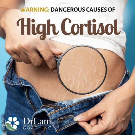 Do you feel constantly stressed and overwhelmed? Have you noticed strange symptoms such as increased sweating and weight gain? These issues could be linked to a medical condition known as high cortisol levels. If you would like to learn more about the causes, testing and care options for high cortisol levels, read the article to discover how to manage this condition. #highcortisol #cortisol #hormones #hormonalimbalance #stress #adrenalfatigue #drlamcoaching High Cortisol Levels, Symptoms Of High Cortisol, Cortisol Manager, High Cortisol, Adrenal Health, Fatigue Syndrome, Medical Tests, Cortisol Levels, Adrenal Fatigue