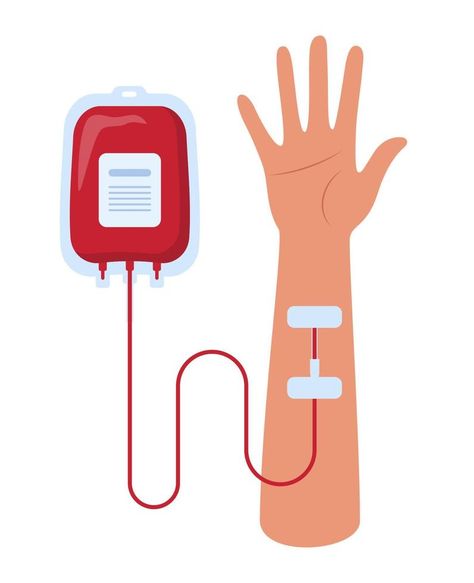 Blood bag and hand of donor or patient. Blood transfusion. Blood donation. Concept vector illustration. Blood Illustration, Backgrand Instagram, Iron Overload, Blood Bag, Donate Blood, Illustration Advertisement, Bag Illustration, Blood Donor, Blood Art