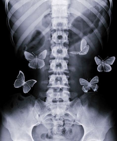 Xray Art, Butterflies In My Stomach, Wallpaper Estetika, Arte Grunge, Butterfly Poster, Aesthetic Grunge, Couple Aesthetic, Vintage Movies, Grunge Aesthetic