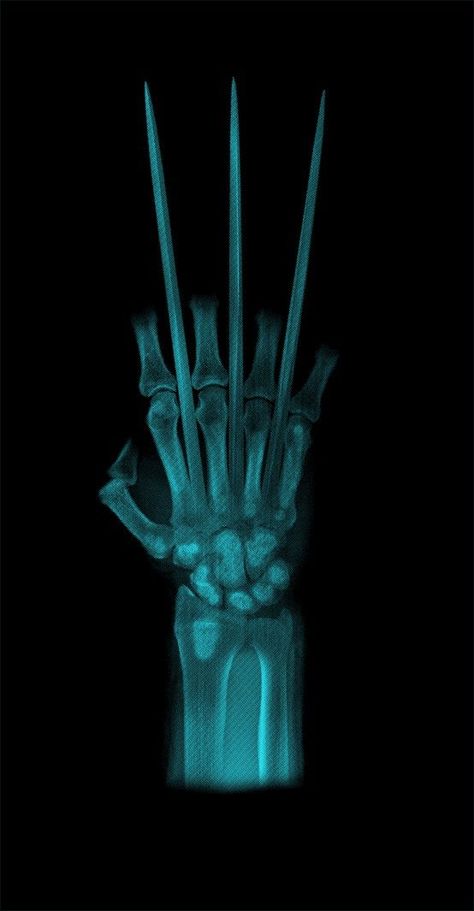 Wolverine Claws X Ray iPhone Wallpaper - iPhone Wallpapers Wolverine Aesthetic Wallpaper, Wolverine Funny, Wolverine Aesthetic, Comic Cloud, Healing Factor, Wolverine Artwork, Wolverine Claws, Facial Bones, Wolverine Comic