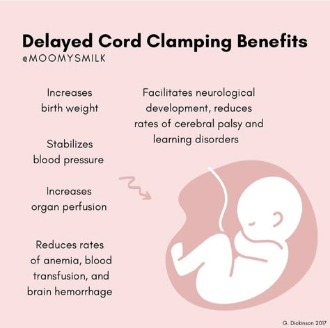 Cord Clamping Delayed, Holistic Birth, Birthing Plan, Labor Doula, Delayed Cord Clamping, Birth Facts, Pregnancy Facts, Birth Preparation, Pregnancy Help