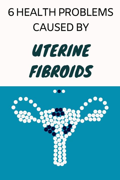 uterine fibroids Fibroid Diet, Fibroid Uterus, Fibroid Surgery, Fibroid Tumors, S Alphabet, Daily Health Tips, Environmental Factors, Fitness Advice, Good Health Tips